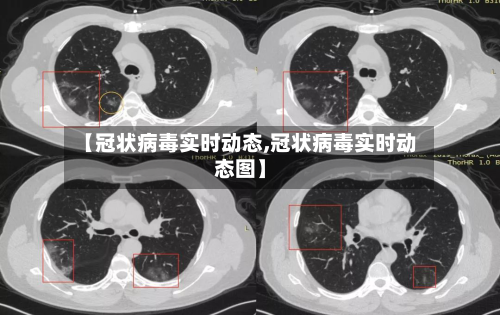【冠状病毒实时动态,冠状病毒实时动态图】