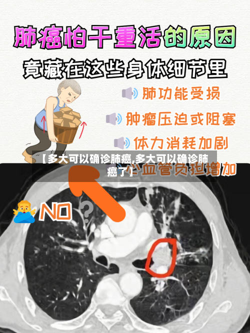 【多大可以确诊肺癌,多大可以确诊肺癌了】