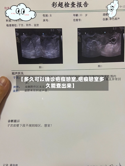 【多久可以确诊疤痕憩室,疤痕憩室多久能查出来】