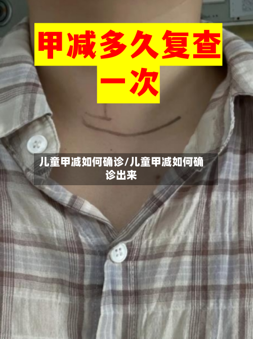 儿童甲减如何确诊/儿童甲减如何确诊出来