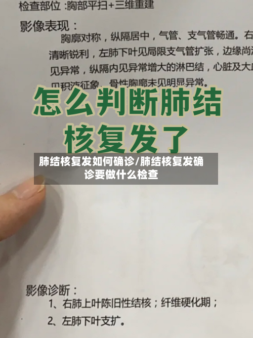 肺结核复发如何确诊/肺结核复发确诊要做什么检查