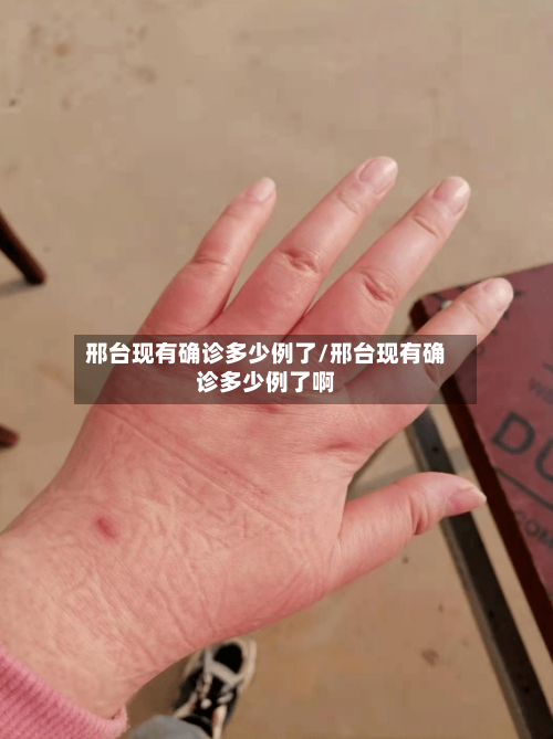 邢台现有确诊多少例了/邢台现有确诊多少例了啊