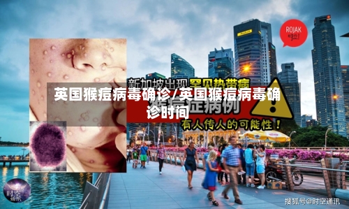 英国猴痘病毒确诊/英国猴痘病毒确诊时间