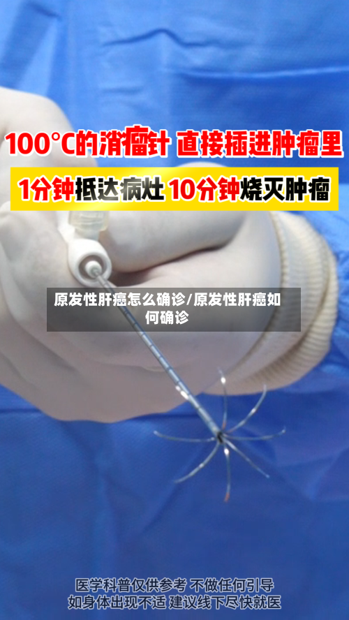 原发性肝癌怎么确诊/原发性肝癌如何确诊