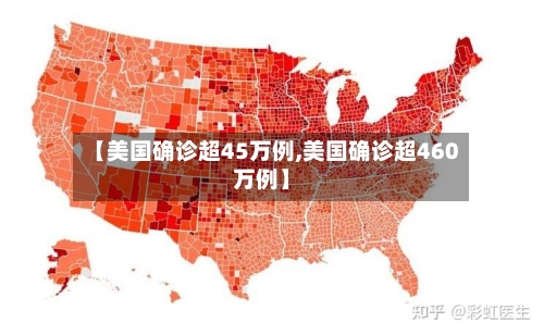 【美国确诊超45万例,美国确诊超460万例】