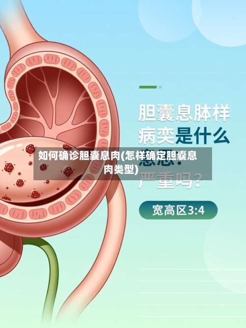如何确诊胆囊息肉(怎样确定胆囊息肉类型)