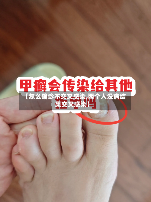 【怎么确诊不交叉感染,两个人没病结果交叉感染】
