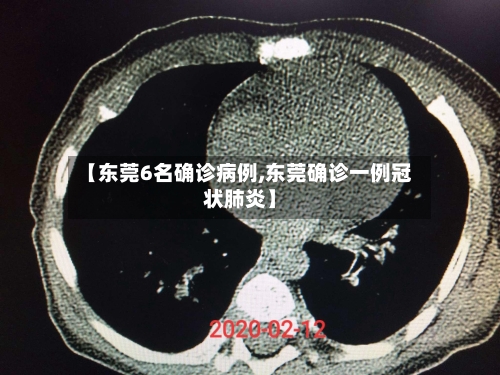 【东莞6名确诊病例,东莞确诊一例冠状肺炎】