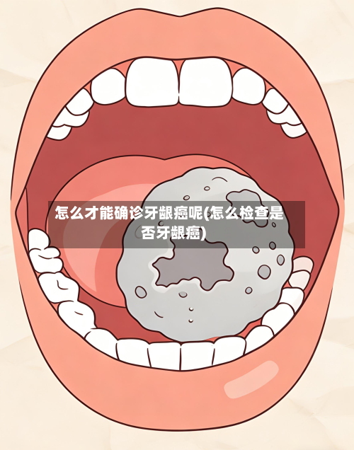 怎么才能确诊牙龈癌呢(怎么检查是否牙龈癌)