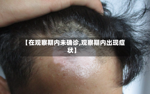 【在观察期内未确诊,观察期内出现症状】