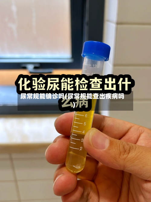 尿常规能确诊吗(尿常规能查出疾病吗)