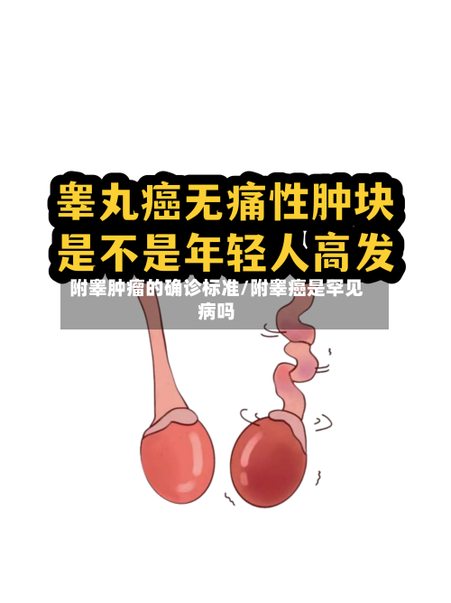 附睾肿瘤的确诊标准/附睾癌是罕见病吗