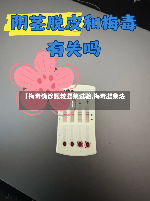 【梅毒确诊颗粒凝集试验,梅毒凝集法】
