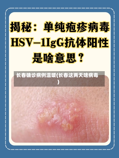 长春确诊病例温暖(长春这两天啥病毒)