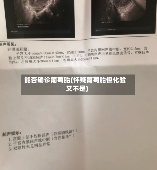 能否确诊葡萄胎(怀疑葡萄胎但化验又不是)
