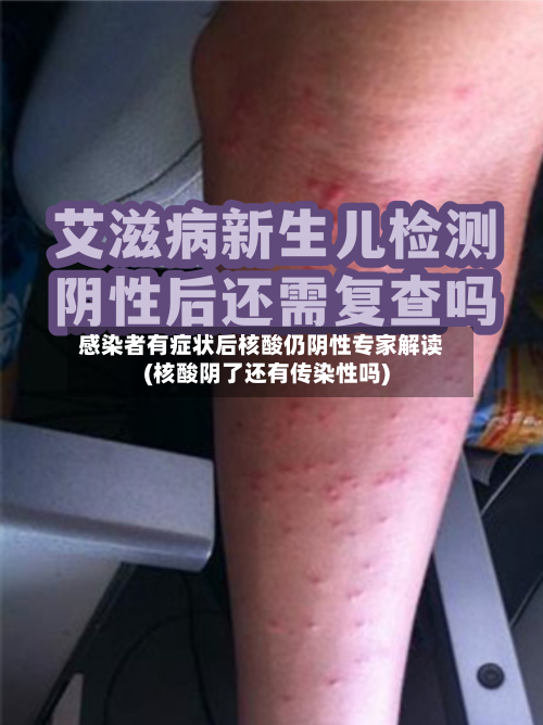 感染者有症状后核酸仍阴性专家解读(核酸阴了还有传染性吗)