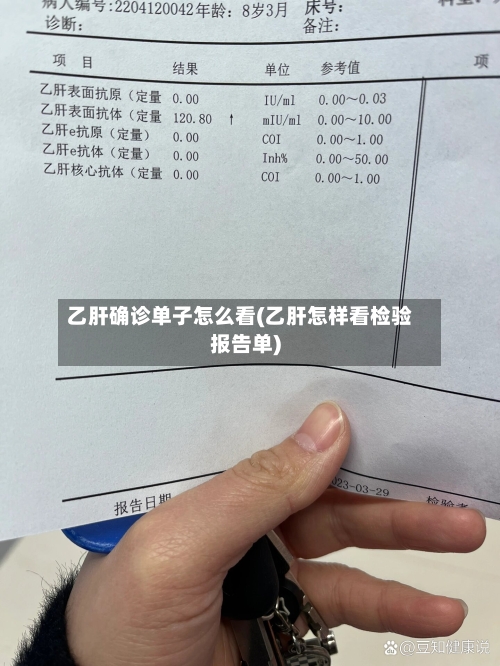 乙肝确诊单子怎么看(乙肝怎样看检验报告单)