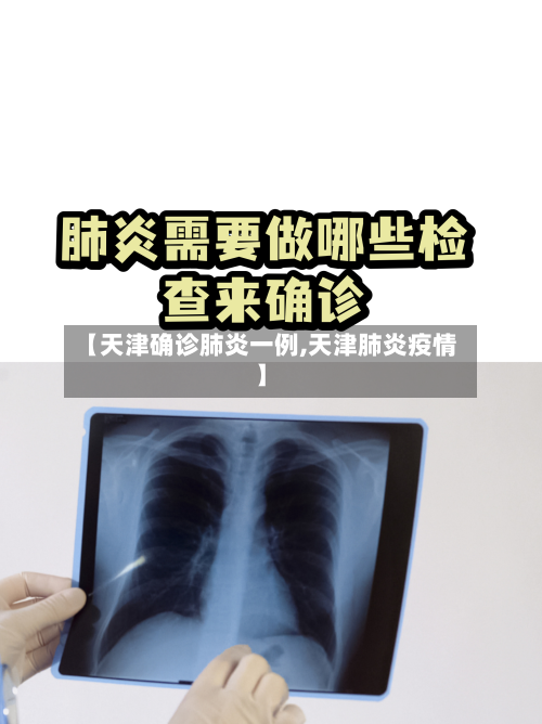 【天津确诊肺炎一例,天津肺炎疫情】