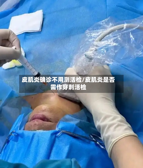 皮肌炎确诊不用测活检/皮肌炎是否需作穿刺活检