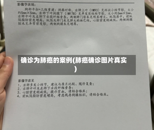确诊为肺癌的案例(肺癌确诊图片真实)