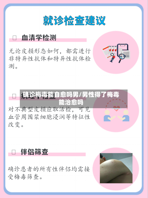 确诊梅毒能自愈吗男/男性得了梅毒能治愈吗