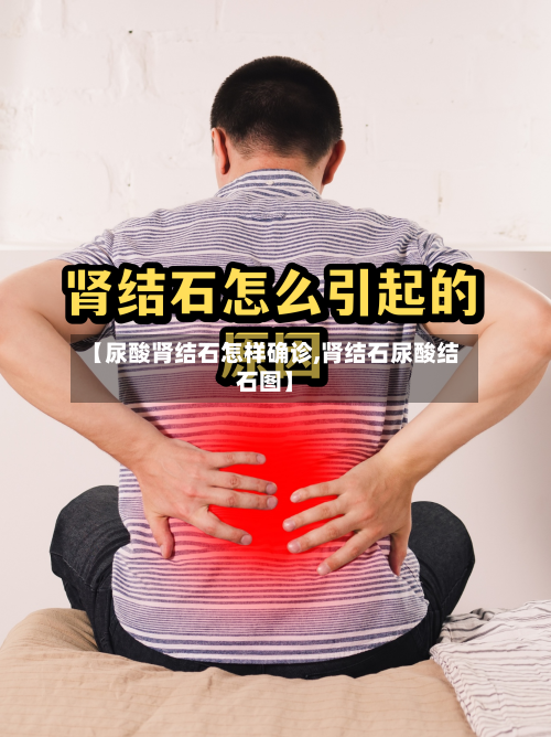 【尿酸肾结石怎样确诊,肾结石尿酸结石图】