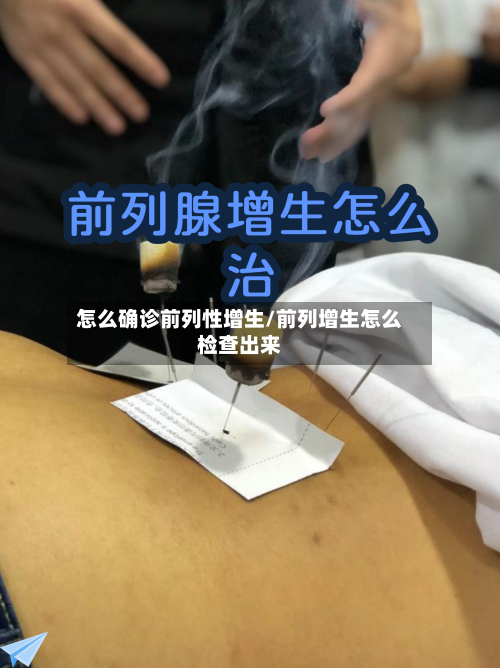 怎么确诊前列性增生/前列增生怎么检查出来