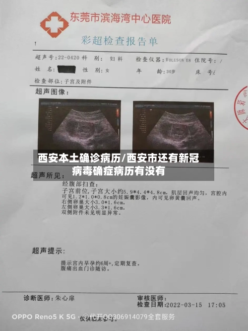 西安本土确诊病历/西安市还有新冠病毒确症病历有没有