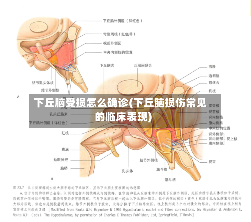 下丘脑受损怎么确诊(下丘脑损伤常见的临床表现)
