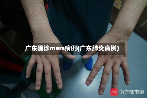 广东确诊mers病例(广东肺炎病例)