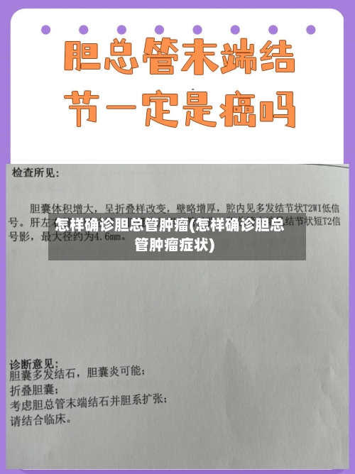 怎样确诊胆总管肿瘤(怎样确诊胆总管肿瘤症状)