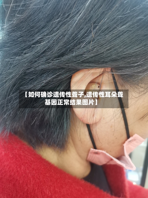 【如何确诊遗传性聋子,遗传性耳朵聋基因正常结果图片】