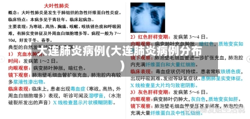 大连肺炎病例(大连肺炎病例分布)