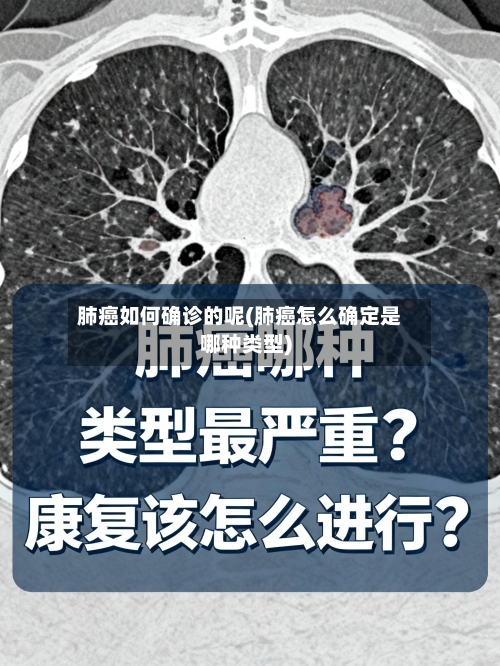 肺癌如何确诊的呢(肺癌怎么确定是哪种类型)