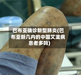 巴布亚确诊新型肺炎(巴布亚新几内的中国艾滋病患者多吗)