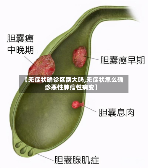 【无症状确诊区别大吗,无症状怎么确诊恶性肿瘤性病变】