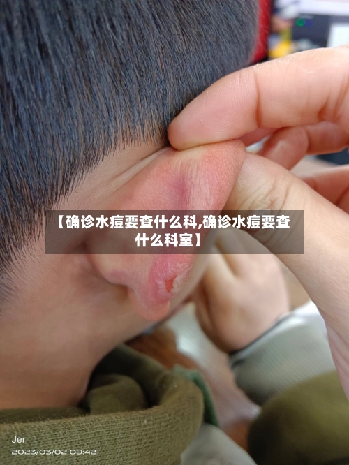【确诊水痘要查什么科,确诊水痘要查什么科室】