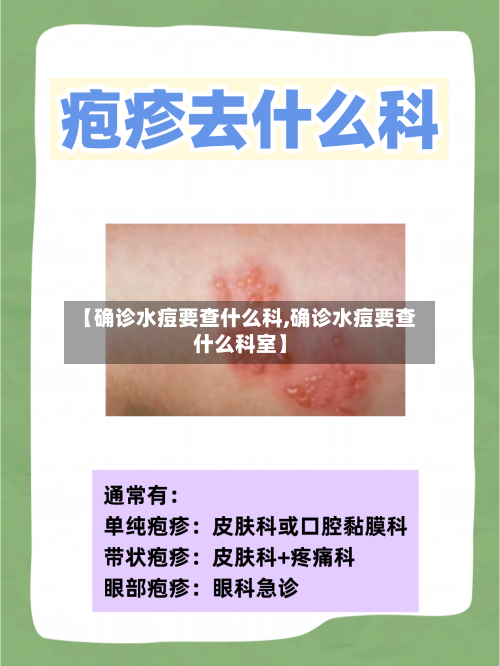 【确诊水痘要查什么科,确诊水痘要查什么科室】